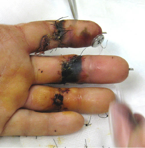 fingers10nov112.jpg